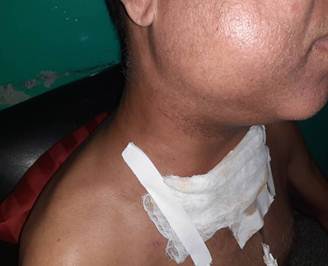 Imagen que muestra el edema facial.