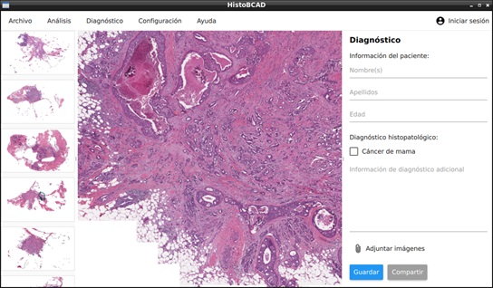 gráfica de usuario de la herramienta software HistoBCAD.