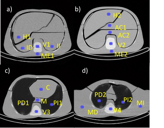 Regiones de interés trazadas en órganos y tejidos en las diferentes regiones anatómicas del abdomen (a-b, protocolo A4, CTDIvol 13,8mGy) y tórax (c-d, protocolo T1, CTDIvol 8,6mGy) para la estimación de los parámetros relacionados con la calidad de imagen tarea-orientados.
