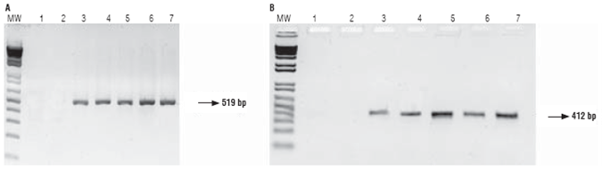 Gel electrophoresis of RT-PCR products using primers CRY1F (A) and PAT (B). MW: molecular weight marker, 1: negative control, 2: parental 81 (non-GM), 3: parental 28 (GM), 4: hybrid 286 x 285, 5: hybrid 288 x 287, 6: hybrid 289 x 290, 7: positive control (parental 28 DNA).