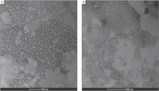 Electron micrographs of positive virus controls. A. CMV; B. PVY (Potyvirus).