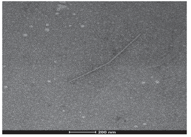 Viral structure (PVY) in leaf samples collected from tree tomato plants in Tumbaco locality.