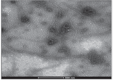 Viral structure (PVY) in leaf samples collected from tree tomato plants in Polileo locality.