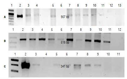 RT-PCR assay of transformed plants. A) Plants transformed with cassettes E-IGP and E-IGP2, primers: E-IGP 1, molecular weight marker (MW); 2, positive control; 3-5, plants transformed with cassette E-IGP; 6-11, plants transformed with cassette E-IGP2; 12, negative control; 13, absolute control. B) Amplification of endogenous gene with Actine primers. 1, MW; 2-11, evaluated plants; 12, absolute control. C) Plants transformed with cassette E-2, primers E-2.1, MW; 2, positive control; 3-9, evaluated plants; 10, negative control; 11, absolute control.