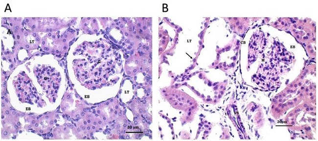 Fotomicrograf&iacute;as &oacute;pticas de corteza renal. Serie A. A: Ri&ntilde;&oacute;n de rata control negativo con caracter&iacute;sticas histol&oacute;gicas normales. B: Rata control positivo de 56 d&iacute;as de evoluci&oacute;n con da&ntilde;o renal
