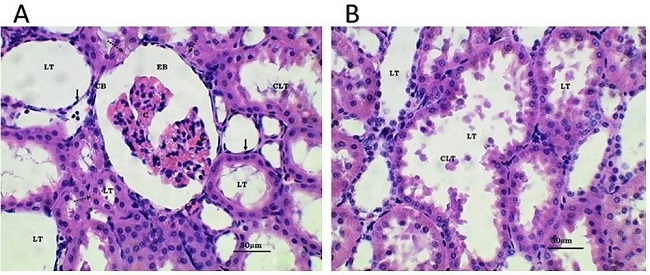 Fotomicrograf&iacute;as &oacute;pticas de corteza renal. Serie B. A y B: Ri&ntilde;&oacute;n de rata control positivo, tratada con soluci&oacute;n salina en dosis &uacute;nica