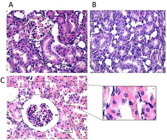 Fotomicrograf&iacute;as &oacute;pticas de corteza renal. Serie B. A, B y C: Ri&ntilde;&oacute;n de rata experimental, tratada con EGF en dosis &uacute;nica