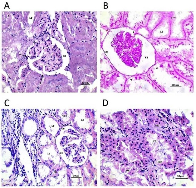 Fotomicrograf&iacute;as &oacute;pticas de corteza renal. Serie C. A, B, C y D: Ri&ntilde;&oacute;n de rata del grupo control positivo, tratada con soluci&oacute;n salina en dosis m&uacute;ltiples