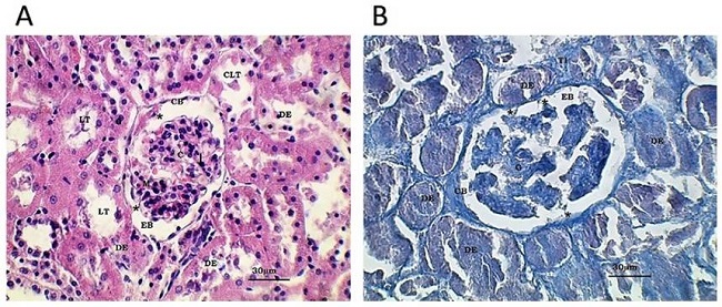 Fotomicrograf&iacute;as &oacute;pticas de corteza renal. Serie C. Microscop&iacute;a &oacute;ptica. A y B: Ri&ntilde;&oacute;n de rata del grupo experimental tratada con EGF en dosis m&uacute;ltiples