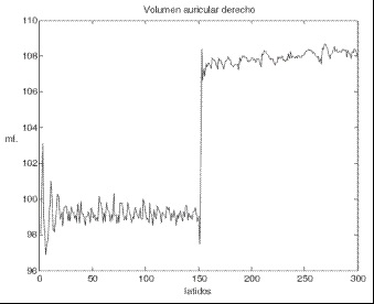 Volumen auricular derecho cuando ocurre un aumento de la presión arterial media (PAM)