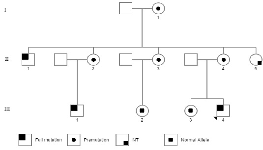 Pedigree of affected family. This pedigree shows the classic pattern of Fragile X Syndrome, women carrying the premutation had sons with full mutation showing the expansion in the number of the trinucleotide CGG repeats. The squares in the upper left corner denote affected males (full mutation); the central dots represent female carriers (premutation); small centered squares represent unaffected females (normal allele); the small square in the lower right corner indicates an individual that was not tested (NT); open symbols represent normal individuals