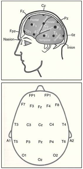 Imagen del cerebro con las principales localizaciones utilizadas en la colocaci&oacute;n de los electrodos de registro EEG, seg&uacute;n la Norma 10-20
