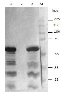 Análisis mediante Western blot de la solubilidad de la proteína L1-tag obtenida en E. coli BL21(DE3) [pET28a-HPV-18 L1-tag]. Se aplicaron 15 μl de cada muestra. Carriles: 1. Fracción Total; 2. Fracción Soluble; 3. Fracción Insoluble; M. Patrón de peso molecular Broad Range Protein Molecular Weight Markers (Promega, EEUU.) revelado con Rojo Ponceau. Para la  inmunodeteción de la proteína de interés se utilizó un anticuerpo monoclonal anti-His (Sigma).