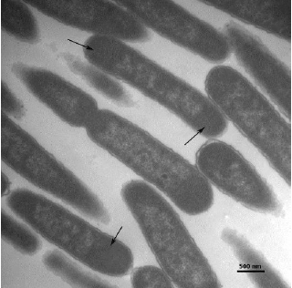 Cortes ultrafinos de células de E. coli BL21(DE3) [pET28a-HPV-18 L1-tag], cultivadas en medio TB e inducidas con 0,1 mmol L-1 de IPTG, observados mediante Microscopia Electrónica de Transmisión. Las flechas indican los cuerpos de inclusión.