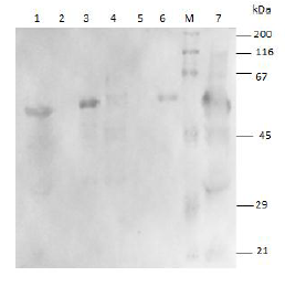Análisis representativo mediante Western blot de la producción de la proteína L1 del VPH-18 en tres cepas de E. coli transformadas con el plasmidio pET28a-HPV-18 L1-tag. Se aplicaron 15 μl de cada muestra. 1: E. coli Origami (DE3) Fracción total; 2: E. coli Origami (DE3) Fracción soluble; 3; E. coli Origami (DE3) Fracción insoluble; 4; E. coli Rosetta (DE3) pLysS Fracción total; 5: E.  coli