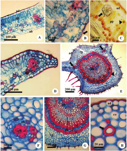 Photomicrographs of cross-sections of the leaf blade. (A) Dorsiventral
mesophyll; (B) Detail of the cells of stomata (arrow); (C) Idioblasts in the
mesophyll with crystals (arrow) and oil (arrowhead); (D) Blade edge; (E) Midrib
showing cylindrical main vascular bundle, sclerenchyma sheath (arrowhead) and
small amphicribal bundle (arrow); (F) Detail of small amphicribal bundle; (G)
Detail of midrib; (H) Sclerified cells (arrow). ad = adaxial surface; ab =
abaxial surface; pp = palisade parenchyma; sp = spongy parenchyma; vb =
vascular bundles; cp = cortical parenchyma; co = collenchyma; sc = sclerified
cells; ss = sclerenchyma sheath; ph = phloem; xl = xylem