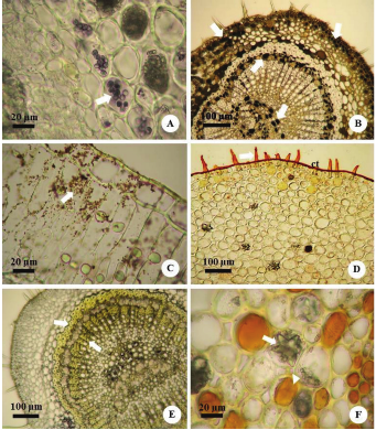 Photomicrographs of
histochemical characteristics of Cordiera sessilis. (A) Presence of
starch sheath (arrow) in the petiole; (B) Phenolic compounds in the midrib
(arrow); (C) Alkaloids (arrow) in the mesophyll; (D) Lipid substances in the
epidermal cells and on the surface of trichomes (arrow) in the petiole, (E)
Lignin in the midrib (arrow); (F) Idioblasts with druses (arrow) and clusters
of single crystals (arrowhead) in the petiole. ct = cutin