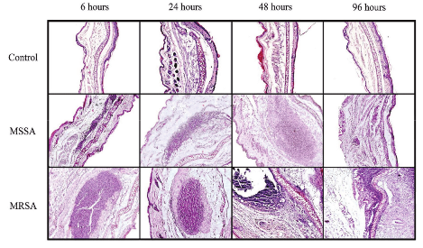 Histopathological analysis of mouse ears. Mice were
infected intradermally in the right ear with methicillin-susceptible Staphylococcus aureus (MSSA) or
methicillin-resistant S. aureus
(MRSA) 6, 24, 48 and 96 hours before euthanasia. Control group received saline
intradermally in the ear. The right ear of each animal group was collected
after euthanasia, fixed in formalin and embedded in paraffin. Sections (5µm)
were prepared and stained with hematoxylin and eosin. After preparation, the
slides were analyzed using light microscope (Magnification 40x). Each group presented
n = 7-9 animals in each experimental poin