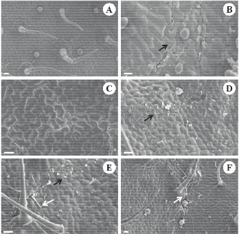 Photomicrographs of adaxial surface in Vitex polygama
Cham. leaflets in the control treatment (A) and when exposed to 5 (B), 10 (C), 15 (D)
and 20 (E and F) mg L-1 KF during 10 days. E, F: fungal hiphae
(white arrows); C and E: epicuticular wax more prominent; B, D, E: epicuticular
wax erosion due to its accumulation (black arrows). Bars=10 µm (B) and 20 µm
(A, C, D, E, F)