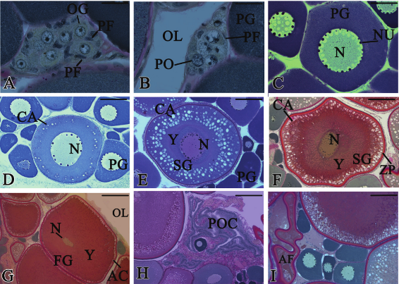 Oocyte
development in Serrasalmus marginatus.
Light microscopy, PAS/Hematoxylin/ Metanil Yellow (A,
B, F, G, H, I), Hematoxilin/Eosin (C, E) and
Toluidine Blue (D). (A) Nest of oogonia is surrounded and among pre-follicle
cells, forming germline cysts. Inside this nest the oogonia are spherical and
voluminous and their nucleus widens with an evident nucleolus, bar = 22 &micro;m. (B)
Cell nest with pachytene oocytes, bar = 29 &micro;m. (C) Ovarian follicle with
primary growth oocyte, bar = 70 &micro;m. (D) Late primary growth oocyte shows the
beginning of the formation of the cortical alveoli, bar = 145 &micro;m. (E) Early
secondary growth oocyte begins the deposition of yolk, formation of the
cortical alveolus, bar = 295 &micro;m. (F), Late secondary growth oocyte, bar = 295
&micro;m. (G) Full-grown oocyte, bar = 590 &micro;m. (H) The postovulatory follicle
complex, bar = 295 &micro;m. (I) Follicular atresia, bar = 295 &micro;m. CA, cortical alveoli; AF, atretic follicle;
BM, basement membrane; F, follicle cell; FG, full-grown oocyte; LO, leptotene
oocytes; N, nucleus; NU, perinuclear nucleoli; OF, ovarian follicle; OG,
oogonium; OL, ovarian lumen; PF, prefollicle cells;
PG, primary growth oocyte; PO, pachytene oocyte; SG, secondary growth oocyte;
Y, yolk globule; ZP, zona pellucida.