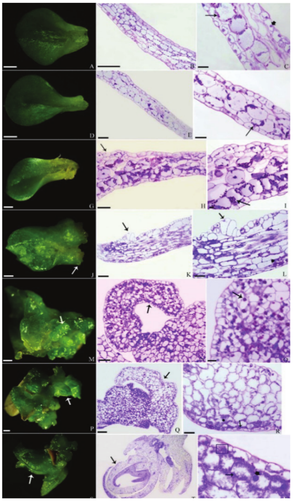 Histological (double-stained: PAS/CBB) aspects of
protocorm-like bodies (PLBs) from leaf explants of C. tigrina A. Rich. (A) Overview of the adaxial surface of the
initial leaf. (B) Cross-section of the initial explant. (C)
Longitudinal section. Blue-stained prominent nuclei (broad arrow) and red-stained
starch granules (arrow). (D) After two days of culture, overview of the adaxial
surface of the leaf. (E) Cross-section of leaf induced after two days of
culture. (F) Red-stained starch granules (arrow). (G) Overview of the adaxial
surface of induced leaf after seven days of culture. (H) Cross-section of the leaf induced after seven days
of culture (arrow). (I) Longitudinal section. Red-stained starch granules
(arrow). (J) On the 14th day of culture, the early formation of PLBs (arrow).
(K) Cross-section of the leaf induced on the 14th day of
culture, with evidence of mitotic activity in the epidermis (arrow). (L)
Longitudinal section. Elongated cells in the epidermis (arrow) and red-stained
starch granules (broad arrow). (M) After 30 days of culture, with many PLBs (arrow)
concentrated at the leaf base. (N) Longitudinal section of a PLB (O) Red-stained starch
granules (arrow). (P) Overview of leaf inoculated at 60 days of culture, yellowish, showing
deterioration, but loads of PLBs (arrow) present at the leaf base. (Q)
Longitudinal section showing the beginning of the formation of leaf (arrow).
(R) Blue-stained prominent proteins (broad arrow) and red-stained starch
granules (arrow). (S) Overview of leaf inoculated at 100 days of culture with a
developed leaf (arrow). (T) PLBs longitudinal sections showing developed leaves
(arrow). (U) Blue-stained prominent nuclei (broad arrow), proteins decorated
with blue (arrow) and red-stained starch granules (square). Bars:
(A, D, T): 1 mm; (G, J, M, P, S): 2 mm; (C, F, I, O, R, U): 50 µm; (E, N): 100
µm; (B, H, K, L, Q): 200 µm.