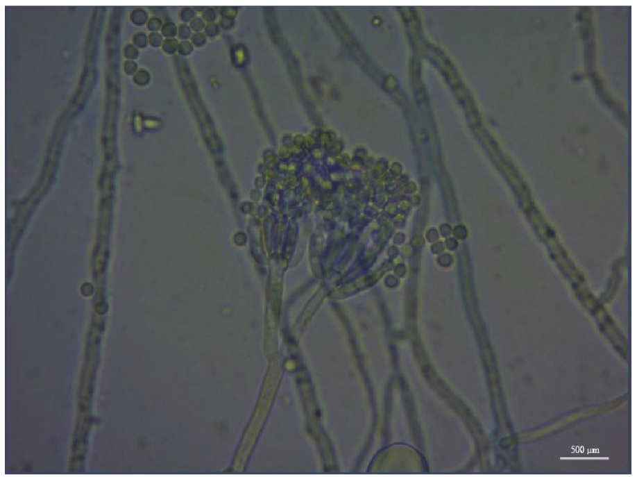 Conidiophores obtained by microcultivation technique.