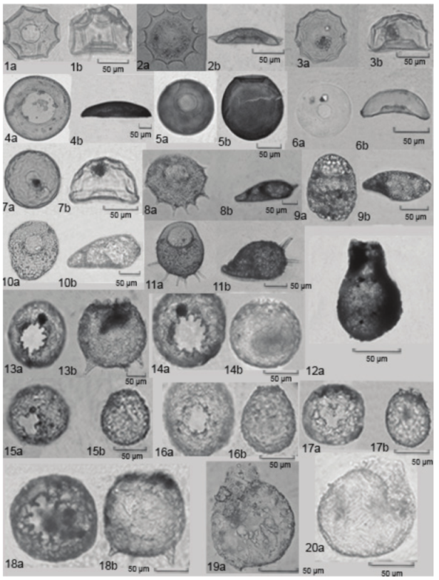 Photo images of testate amoebae
identified – frontal view (a) and lateral view (b). 1. Arcella conica, 2. A. dentata, 3.
A. hemisphaerica var. undulata, 4. A. megastoma,
5. A. mitrata, 6.
A. vulgaris var. penardi,
7. A. vulgaris var. undulata, 8. Centropyxis aculeata, 9. C. constricta, 10. C. ecornis, 11. C. hirsuta, 12. Difflugia pyriformis, 13. D. corona, 14. D. corona var. ecornis, 15. D. gramen, 16. D. lobostoma multilobada, 17. D. pseudogramen, 18. Protocucurbitela coroniformes, 19. Lesquereusia modesta, 20. L. spiralis. Source:
Author.