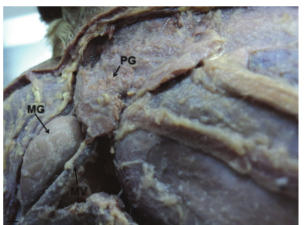  Photograph of
the right lateral face of the crab-eating-fox, presenting the mandibular salivary
gland (MG), parotid gland (PG) and maxillary vein (MV).
