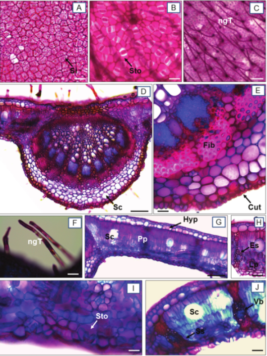 Leaf
anatomy of Xylopia aromatica in
transverse and paradermal sections. A - Frontal view
of the adaxial face; B, C - frontal view of the abaxial face with paracytic stomata and trichomes; D, E – midrib with details
of cuticle, secretory cavities and fibers; F - non-glandular trichomes; G, H, I
- dorsiventral mesophyll; J - detail of leaf edge with vascular bundle and sclerenchymatous
sheath. Legend: Ss – sclerenchymatous sheath; Sc
– secretory
cavities; Cut – cuticle; Sto – stomata; Vb – vascular bundle; Fib – fibers; Hyp – hypodermis; Pp – palisade
parenchyma; Lp – lacunous
parenchyma; Si – silica; ngT – non-glandular
trichomes. Bars: A, B, C, E, F, H, I, J = 40 µm; D, G = 150 µm