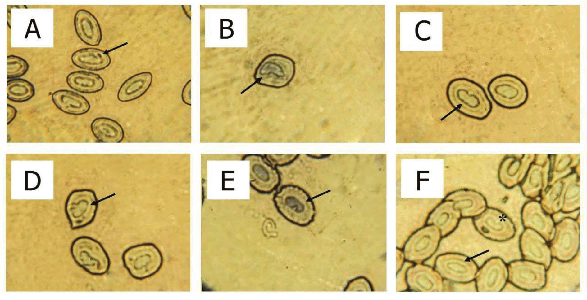 Micronucleus and nuclear abnormalities (stained with Giemsa) found in
erythrocytes of Astyanax bifasciatus
from Iguaçu river. (A) Micronucleus (40X); (B and C) Lobed (40X); (D) Blebbed
(40X) (E) Notched (40X) (F) normal cell (arrow) (40X) and Notched (*). 

 