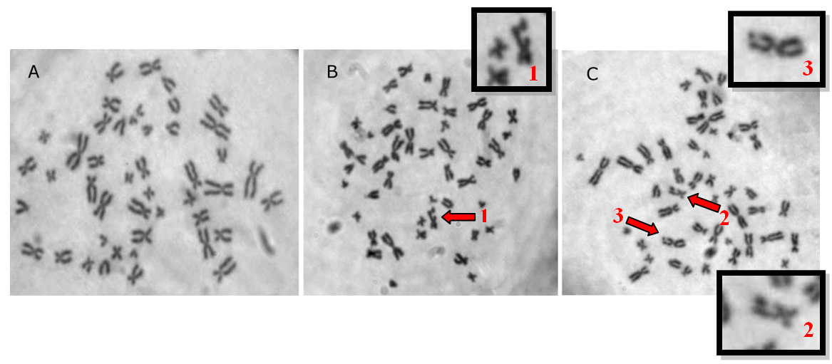 Chromosomal aberrations observed on Metaphase of peripheral human blood lymphocytes. A. Negative Control - Normal metaphase; B. Cells exposed to doxorubicin (1- Chromatidic break); C. Cells exposed to cis-[Ru(C2O4)(NH3)4]2(S2O6) complex at a concentration of 150 M (2 - Chromatidic gap; 3 - Chromatidic break).