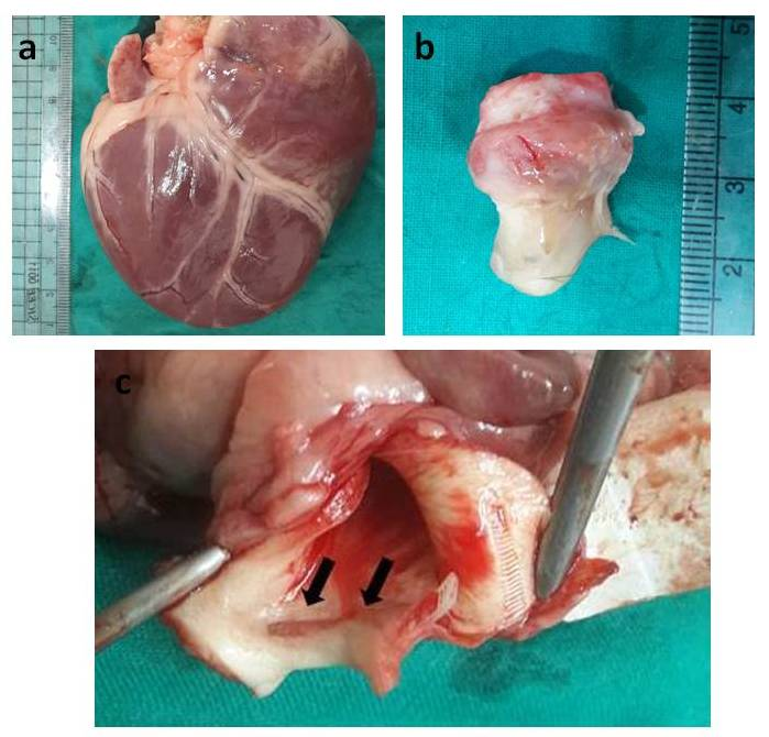 (a) Post-mortem photograph of the heart at 6 months after banding of the aorta using the nylon tie demonstrating marked hypertrophy of the heart. (b), (c) Post-mortem photograph of the ascending aorta at 6 months after banding of the aorta. A whitish fibrous tissue foreign body reaction was seen encapsulating the nylon tie (arrows).