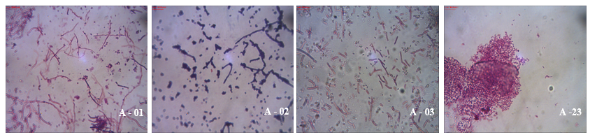 Photos of inoculum made with ACQ culture medium (100X digital optical microscope).