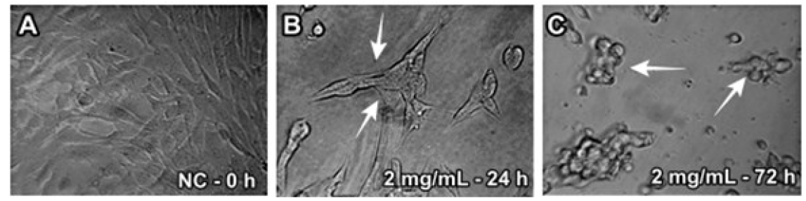 Figure 3. Cytotoxic effect of Sphagneticola trilobata extract (2.0 mg mL-1) on morphology of 3T3 cells comparing: (A) Negative Control - 0 h; (B) acute exposure (24 hours); (C) chronic exposure (72 hours) exposure. The arrows indicate morphological alterations and cell death.
