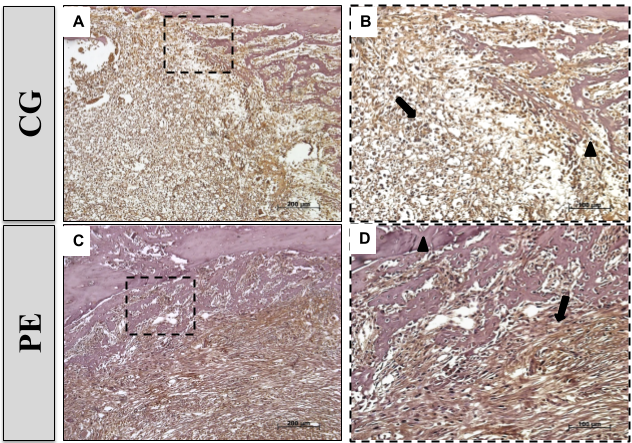 Figure 10. Representative photomicrographies for Cox-2 immunohistochemistry of Control group (A and B) and PE (C and D) 7 days after surgery. Cox-2 immunostaining (↓). Defect Edge (▲)