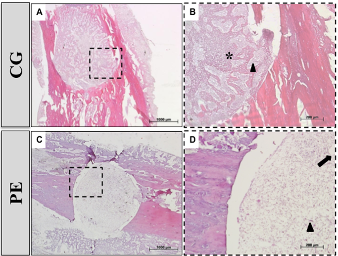 Figure 7. Histological sections of the CG and PE groups, 7 days after implantation. *: Newly formed bone; ▲: granulation tissue; ↓: residue of the material. 2.5x magnification (7 A and 7 C) and dashed box indicates the region selected for analysis with 10x magnification (7 B and 7 D). HE staining.