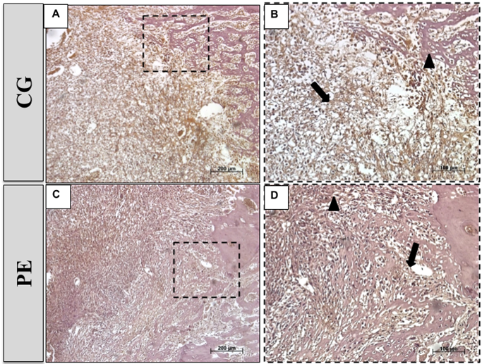 Figure 8. Representative photomicrographies for Runx-2 immunohistochemistry of CG (A and B) and PE (C and D) 7 days after surgery. Runx-2 immunostaining (↓). Defect Edge (▲).