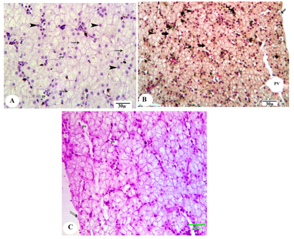 Figure 1. Photomicrograph of the liver of control metamorphed tadpole of Egyptian toad showing normal structure and collagen fibers and glycogen distributions; hepatic sinusoids (arrowhead), capsule (double arrows), blood vessel (arrowhead), peripheral area (arrow), glycogen content (magenta). (A, H&E; B, Masson's trichrome and C, PAS, scale 30 ).