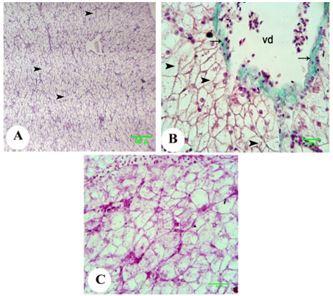 Figure 2. Photomicrograph of the liver of the metamorphed tadpole of Egyptian toad exposed to atrazine dosage 300 g L-1 showing degeneration of hepatocytes (arrowhead), vasodilatation of central vein (vd), with appearance of fibrosis at its wall (arrow), and depletion in glycogen content (magenta) from cytoplasm with concentration in hepatocytic nuclei. (A, H&E; B, Masson's trichrome and C, PAS, scale 30 ).