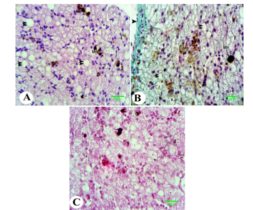 Figure 3. Photomicrograph of the liver of metamorphed tadpole of Egyptian toad exposed to nitrate dosage 200 mg L-1  showing severe accumulation of lipid droplets in the cytoplasm of hepatocytes (double arrowheads) with great aggregation of melanomacrophage cells in between the hepatocytes (Mm), thickness of collagen fibers of hepatic capsule (arrowhead), depletion of glycogen in the cytoplasm of hepatocytes (magenta). (A, H&E; B, Masson's trichrome and C, PAS, scale 30 ).