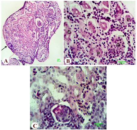 Figure 5. Photomicrograph of the kidney of control metamorphed tadpole of the Egyptian toad showing normal architecture of kidney and normal capsule (double arrows), normal proximal tubules (P), distal tubule (D), Malpighian corpuscles formed of double walled Bowman's epithelium (arrow) and normal glomerulus (G). (A, B H&E; C, Masson's trichrome, scale 30 ).