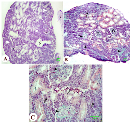 Figure 6. Photomicrograph of the kidney of metamorphed tadpole of the Egyptian toad exposed to atrazine dosage 300 g L-1 showing great reduction in the formation of the renal tubules with undifferentiated mesenchyme (white arrowhead), destruction of the double walled Bowman's epithelium (zigzag arrow), vasodilation (vd), leucocyte infiltration (arrow) with fibrosis exhibited in both the glomerulus and the parenchyma (dark arrowhead) and deformation in renal tubules (double arrows). (A, H&E; B, C, Masson's trichrome, scale 30 ).