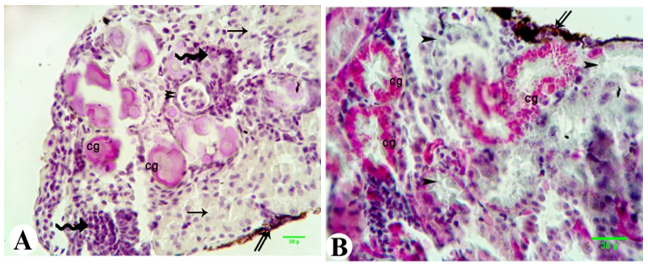 Figure 7. Photomicrograph of the kidney of metamorphed tadpole of the Egyptian toad exposed to nitrate dosage 200 mg L-1 showing congestion in the renal tubules (cg), deformation of renal tubules (arrow), leucocytes infiltration (zigzag arrow), thickness of Bowman's epithelium (double arrowheads), fibrosis (arrowhead) and thickness in the wall of renal capsule (double arrows). (A, H&E; B, Masson's trichrome, scale 30 ).