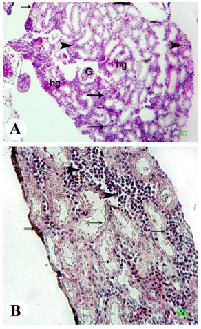 Figure 8. Photomicrograph of the kidney of metamorphed tadpole of the Egyptian toad exposed to the combination dosage of atrazine and nitrate showing degeneration of the renal tubules (arrow), atrophy of glomerulus with deformation of Bowman’s epithelium (G), great leucocytes infiltration (black arrowhead), hemorrhage (hg), thickness in the wall of renal capsule (double arrows), and the atrophic testis attached to the kidney (white arrowhead). (A, H&E; B, Masson's trichrome, scale 30 )