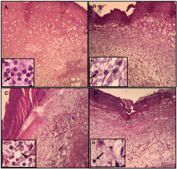 Figure 2. Cutaneous wounds photomicrography of mice treated with DqV. Animals received i.v. saline (A, C) or DqV (50 g kg-1 day-1) (B, D) for 3 days. Wounds were removed for histological analysis after 30 min. (A, B) and 6 hours of treatment (C, D). Inflammatory infiltrate of polymorphonuclear cells (arrow); H&E; A, B, C, D (200x); a, b, c, d (600x).