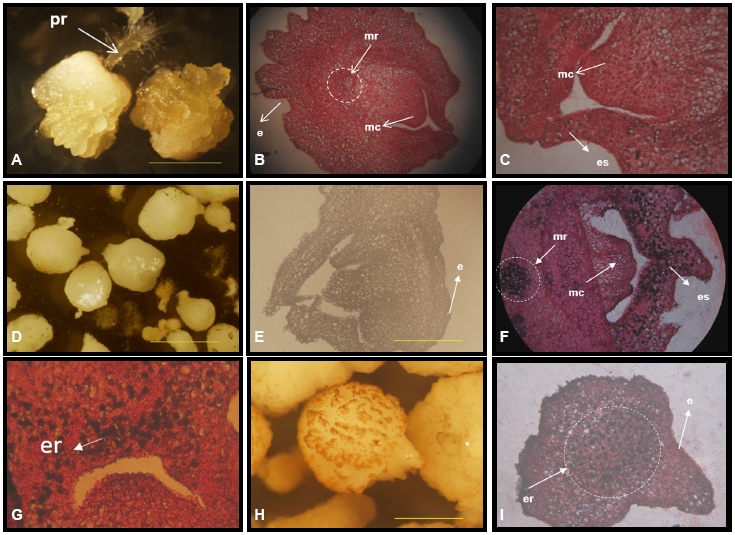 Embriones som&aacute;ticos de pl&aacute;tano cv. &lsquo;FHIA-21&rsquo; (AAAB) en medio
de cultivo l&iacute;quido de maduraci&oacute;n