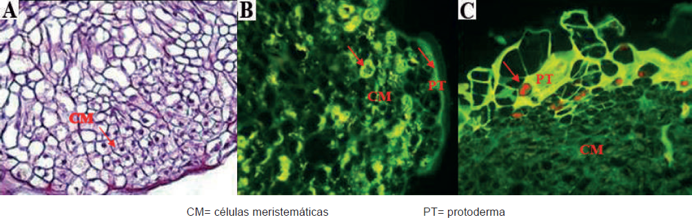 Microfotograf&iacute;a de un corte histol&oacute;gico de un embri&oacute;n som&aacute;tico en estado globular proveniente de Palma Coco Cumb&eacute; (Parajubaea cocoides Burret)