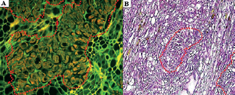 Microfotograf&iacute;a de un corte histol&oacute;gico de callo embriog&eacute;nico de Palma Coco Cumb&eacute; (Parajubaea cocoides Burret)