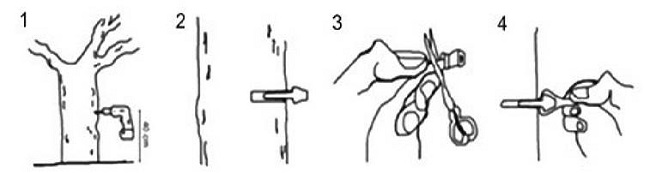 Procedimiento de colocaci&oacute;n de inyecciones