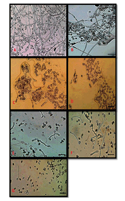 Germinaci&oacute;n in vitro del polen de los genotipos (n=7) de tabaco (Nicotiana tabacum L.) en el medio de cultivo SaCaBor luego de 20 horas de incubaci&oacute;n